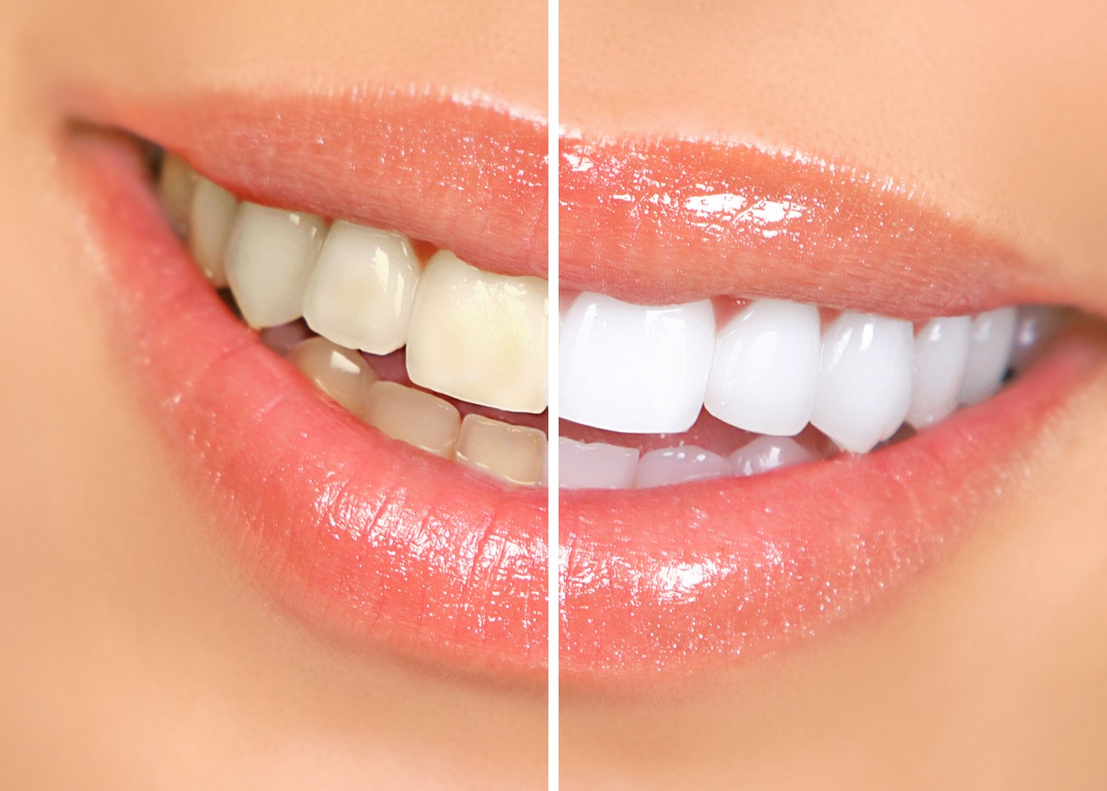Does Vaping Stain Your Teeth? Risks & Fixes Cyclone Pods Does Vaping Stain Your Teeth? Risks & Fixes Cyclone Pods