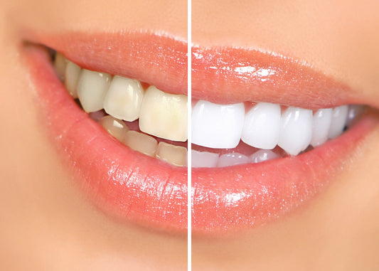 Does Vaping Stain Teeth? (Key Risks & How to Fix It)